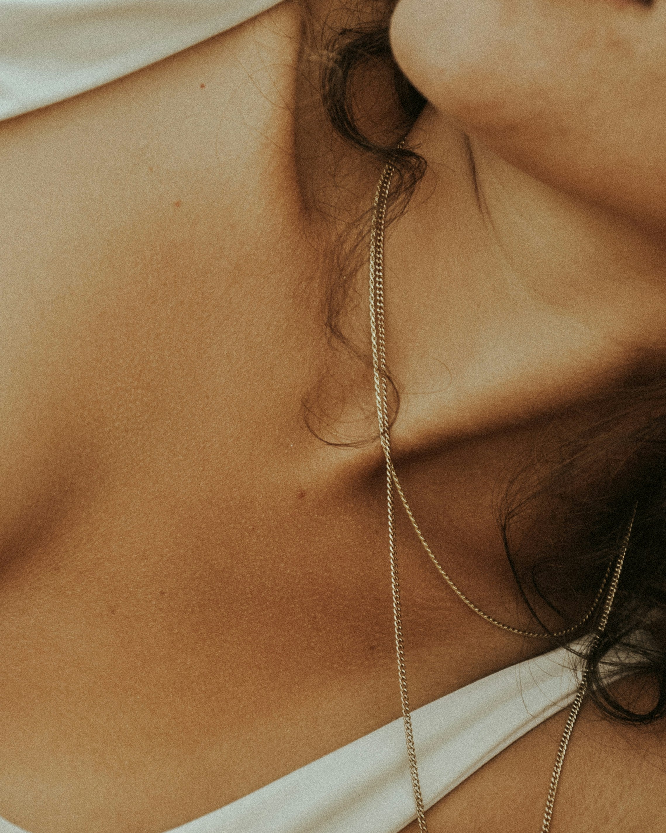 Normal Skin